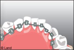 Orthodontie