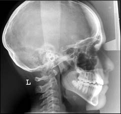 Les maladies des gencives